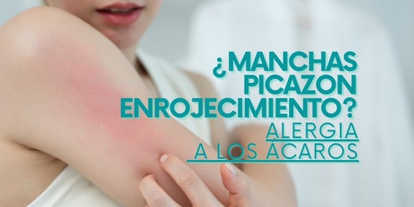 Picor nocturno, piel irritada, enrojecimiento o manchas en la piel